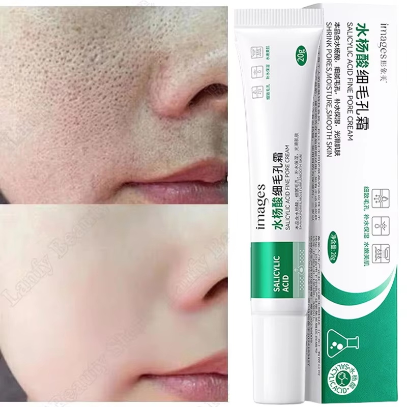 Salicylic Acid Blackhead Remover - ครีมทำความสะอาดรูขุมขนกรดซาลิไซลิก ลดรูขุมขน ขจัดสิวหัวดำ สิว กระจ่างใส ชุ่มชื้น