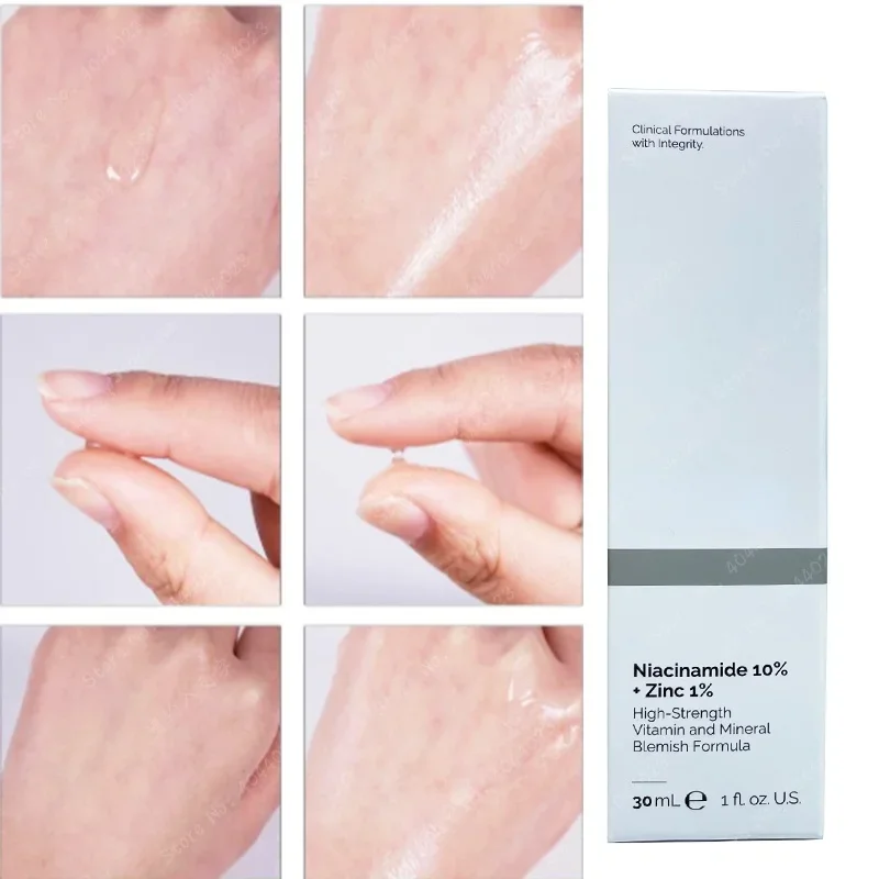 ไนอาซินาไมด์ แมกนีเซียม ไวท์เท - Niacinamide Pore Shrinking Essence บทวิจารณ์และราคา