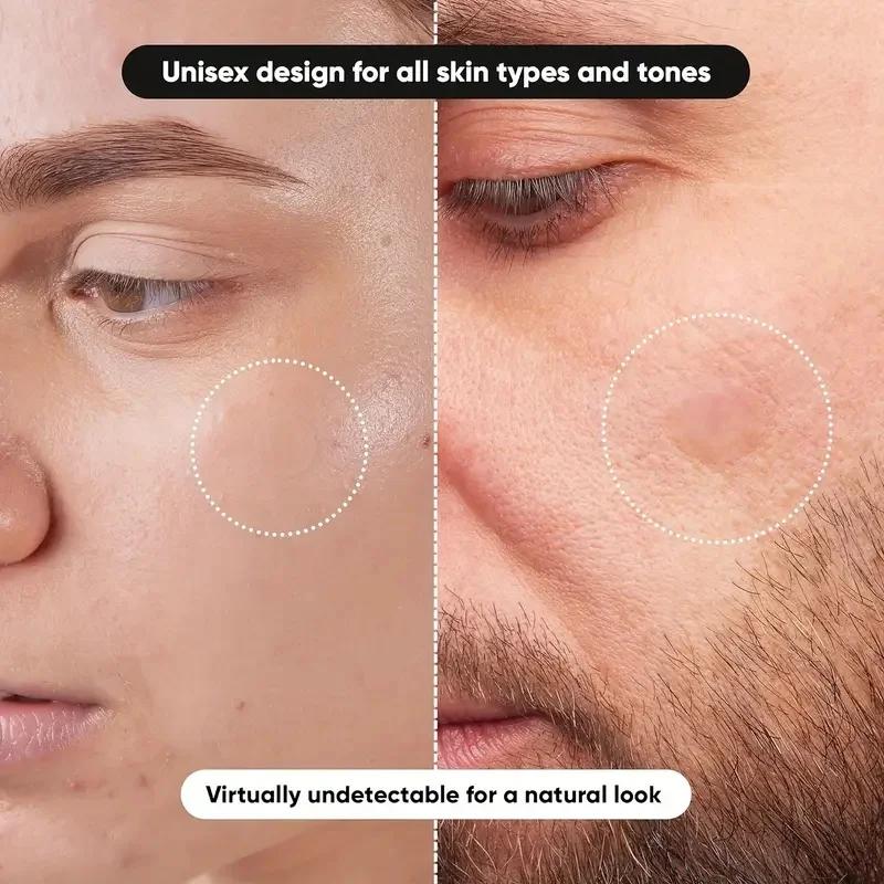 แผ่นแปะสิว 360 ชิ้น/กล่อง - ปร - Massage บทวิจารณ์และราคา